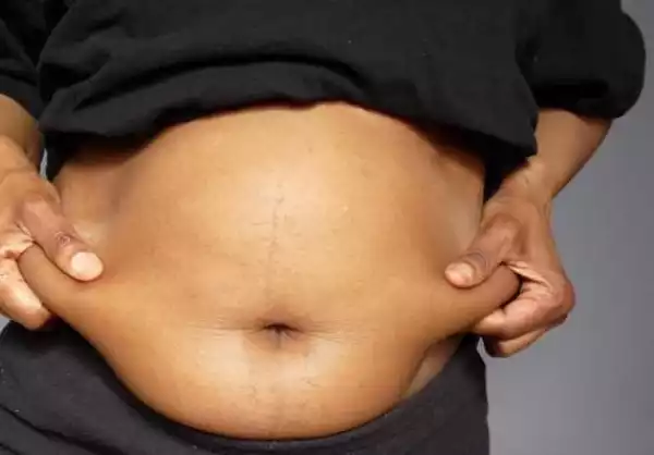[A MUST READ] 3 Reasons Why Nigerian Ladies Have Belly Fat
